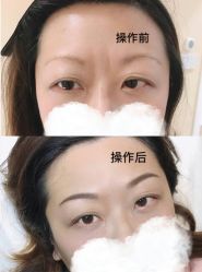 -MIVI半永久纹眉机器野生眉纹唇