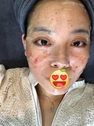 -More摩尔医美の注射线雕光电中心