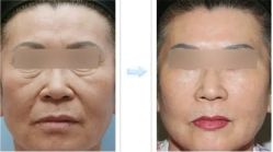 -北京米扬丽格医疗美容·联合丽格鼻整形中心