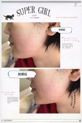 小v脸-光SPA科技美肤