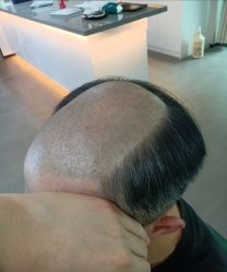 -极客侠男士假发定制补发