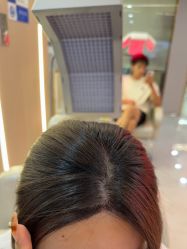 -碧莲盛不剃发植发