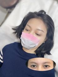 点击看大图 -杨益美学·野生眉半永久纹眉发际线