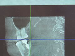 -土豆口腔(凤凰北总店)