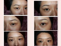 完美隐形眼线客人前后对比-艾妃罗高科美肤美甲美睫健康管理