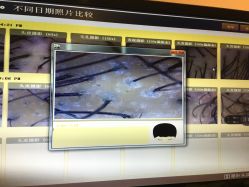 -菩叶头皮抗衰养发护发