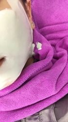 -蕾特恩祛痘•皮肤管理