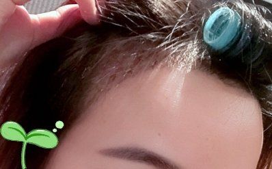 -大麦微针植发丨全国连锁