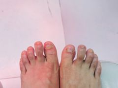 -新甲连锁灰指甲·甲沟炎·鸡眼(黑龙江路店)