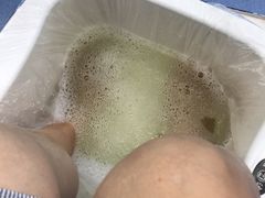 -Andrew指甲专科灰指甲·甲沟炎矫正·3D步态矫形鞋垫定制(浦三路店)