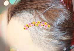 -大麦微针植发全国连锁