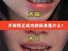 -团圆口腔·种植中心(锦江院区)