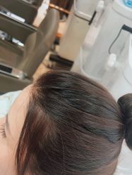 -雍禾植发全国连锁