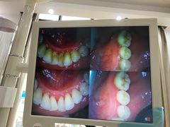 -赫尔森口腔·牙齿种植修复