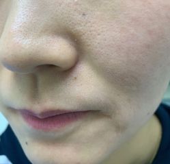 体验前-CMS西美斯·美式医疗美容