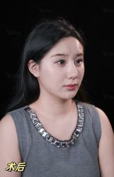点击看大图 -Yestar重庆艺星医疗美容医院