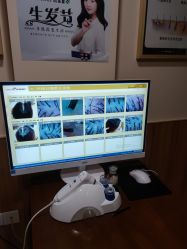 -丝客富脱发养发头皮馆