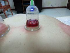android_upload_pic-李时珍中医馆·艾灸·推拿·针灸(佰港城馆)