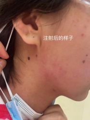 体验后-Yestar艺星医疗美容医院
