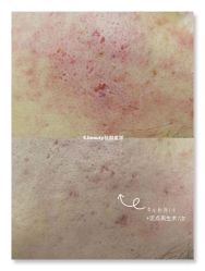 -E.beauty驻颜·痘敏肌调理中心