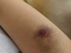 -瑞慈体检上海松江机构