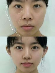 -Yestar重庆艺星医疗美容医院