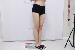 体验前-禾美嘉医疗美容