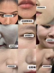 点击看大图 -MLP美丽派·问题肌疗愈中心