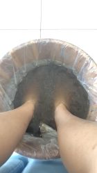 -派恩宜灰指甲·甲沟炎·鸡眼康护