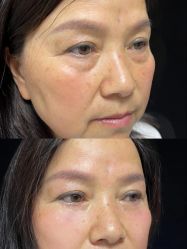 -深圳艺星医疗美容医院