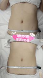 -Lily纤美·科技减脂中心