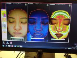 皮肤检测-光SPA科技美肤