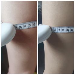 -苗塑堂减肥·艾灸