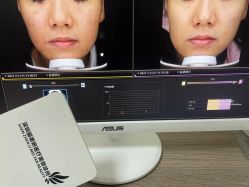 -丽美妍医疗美容·皮秒·立体分层抗衰