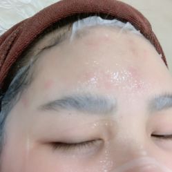 -伊丽莎白医疗美容