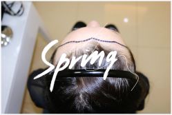 点击看大图 体验后-大麦微针植发全国连锁