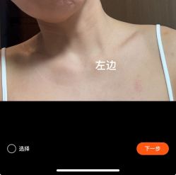 体验前-深圳米兰柏羽医疗美容医院