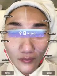 点击看大图 -SKIN79皮肤管理中心