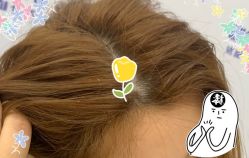 -大麦微针植发全国连锁