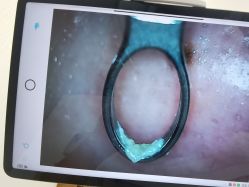 -凡碧诗毛孔清洁收细