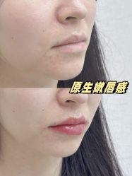 -深圳艺星医疗美容医院
