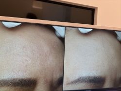-苑苑vbeauty科技美容SPA