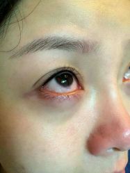 点击看大图 -美莱医学美容医院