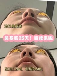 -上海伊莱美医疗美容医院