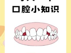 -上海仁爱医院口腔科 · 种植