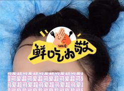 -大麦微针植发全国连锁