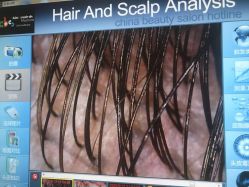 -雍禾植发全国连锁