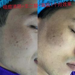 -蕾特恩专业祛痘·皮肤管理