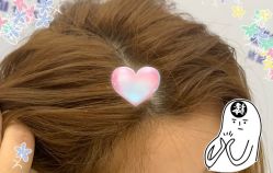 -大麦微针植发全国连锁