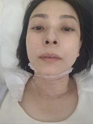 -海涛医疗美容·面部抗衰·注射美鼻